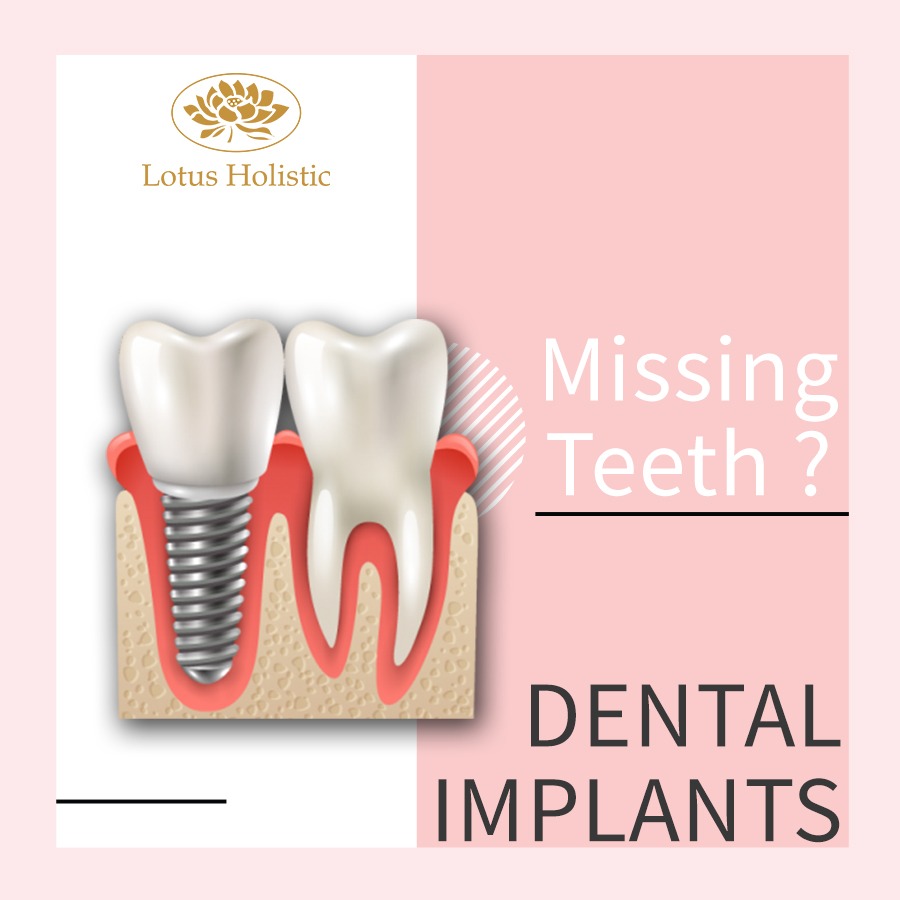 Lotus Dental Clinic Abu Dhabi iSelect